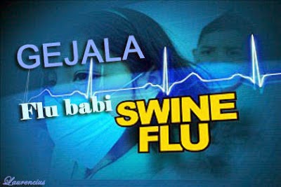 Gejala H1N1 Virus Flu Babi Pada Manusia