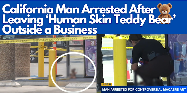 Human Skin Teddy Bear