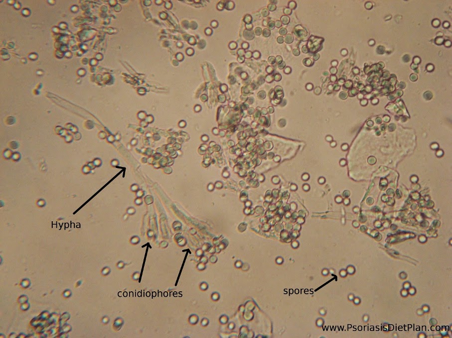 You can see fungal hyphae (body), conidiophores (branches) and spores 