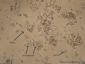 You can see fungal hyphae (body), conidiophores (branches) and spores 