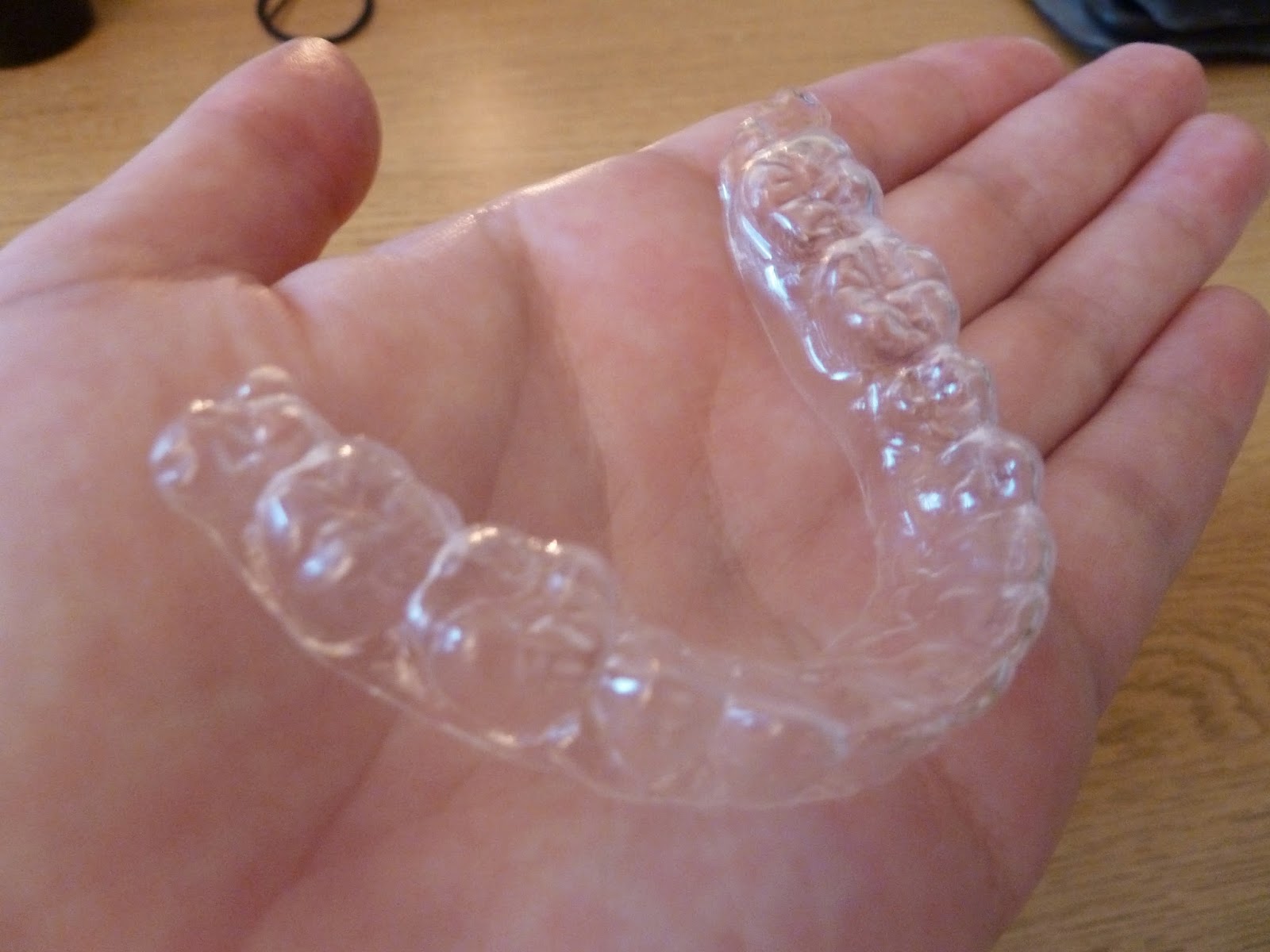 A photo of my removable lower retainer