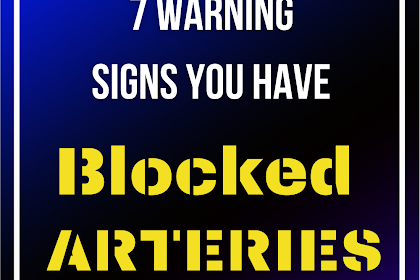 Here Are 7 Warning Signs You Have Blocked Arteries