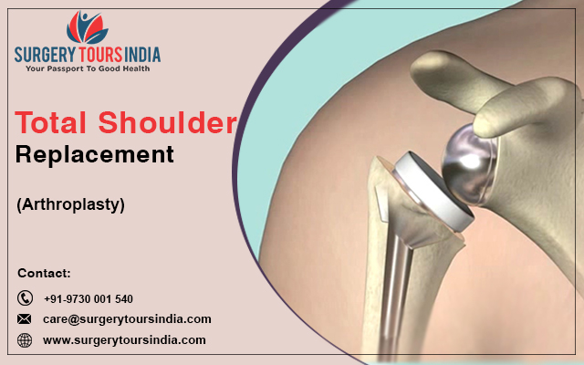 Total Shoulder Replacement Surgery