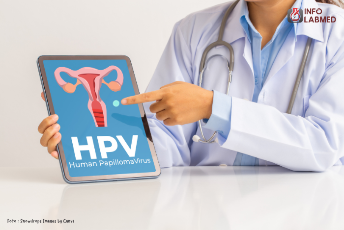 Mengenal Infeksi HPV Penyebab, Gejala, dan Pencegahan