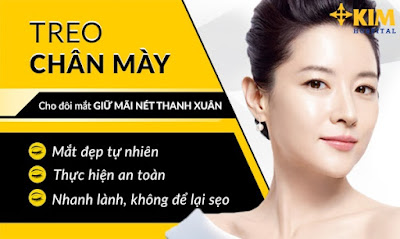 Treo chân mày nội soi