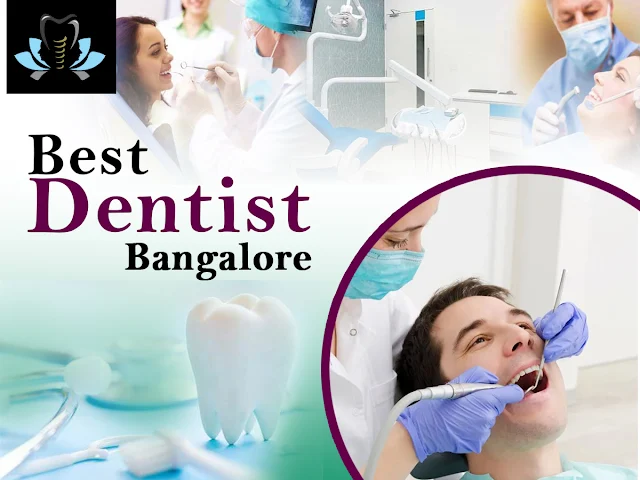 Best dentist Bangalore