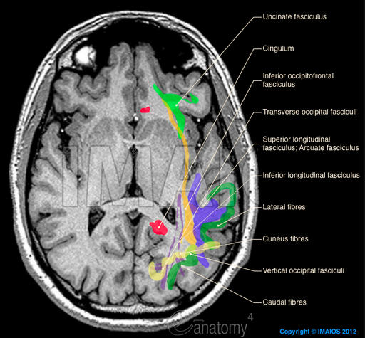 Brain White Matter8