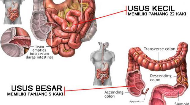 Waspadai 3 Penyakit Kronis pada Usus