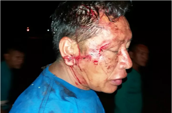 Cacique é agredido a pauladas por jovens em Santa Rosa do Purus