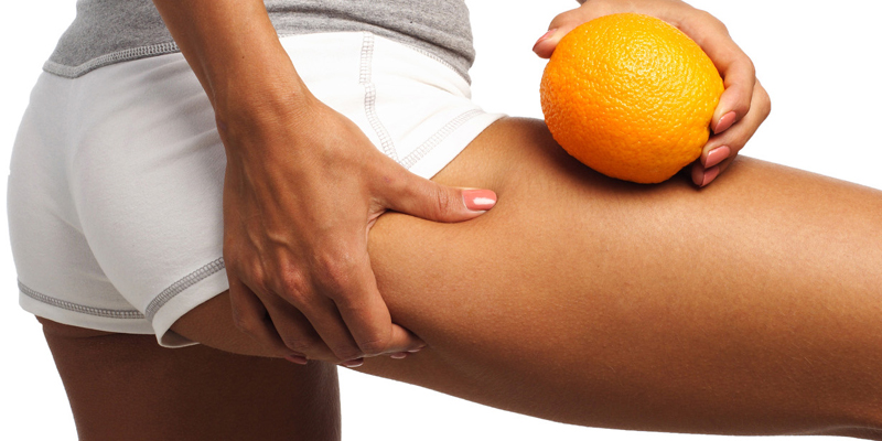 Everything You Need to Know About The Newest Cellulite Treatment 