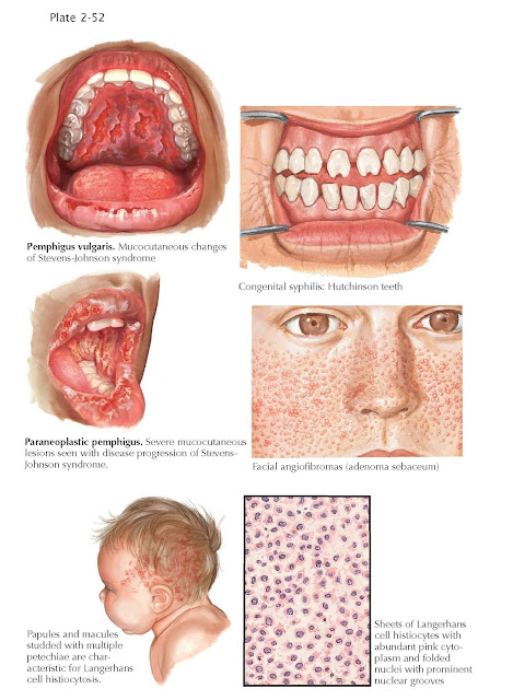 Oral Manifestations in Various Skin Conditions