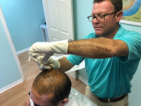 hair loss treatments in Jupiter at NovaGenix for hair restoration in PBC Florida