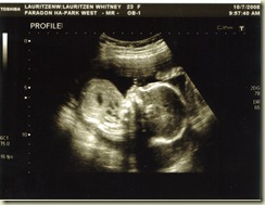 2nd Ultrasound 04 Profile