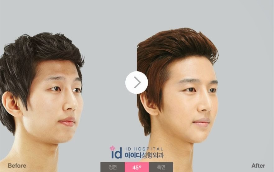 アジア最初の輪郭専門病院 韓国id美容外科です 韓国整形情報 最近男の整形が増えてるのはなぜ