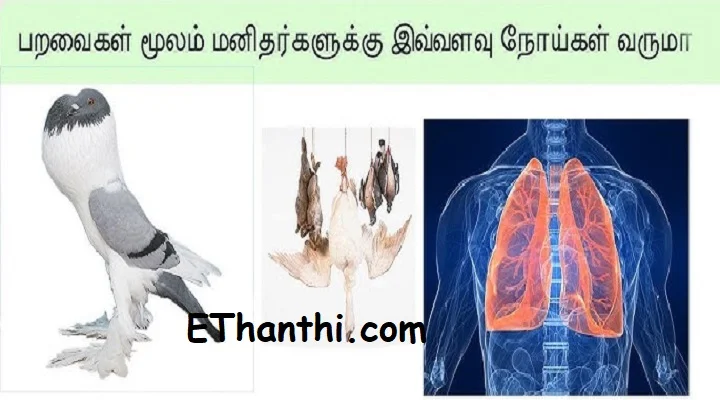 புறா வளர்த்ததால் செயலிழந்த நுரையீரல்... அறுவை சிகிச்சை !