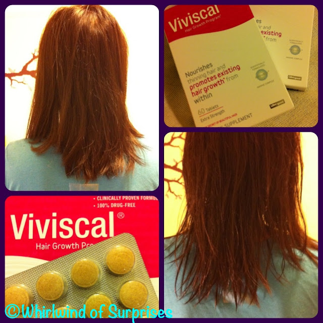 Viviscal review