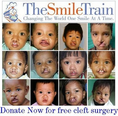 SmileTrain.org - Charity that provides Free Cleft Surgery