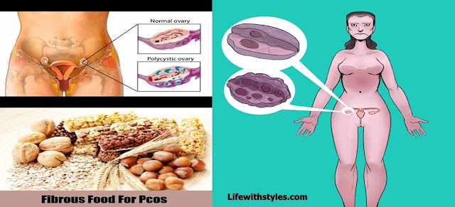 Polycystic Ovary Syndrome (PCOS) - A Common Disease of Which all Women Should Know About- Home Remedies to Cure it!