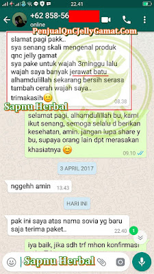 Cara Mengobati Lentigo Secara Alami, Obat lentigo Herbal QnC Jelly Gamat Di Apotik 100% Paling Ampuh