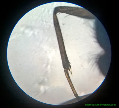 Ant's Leg. Magnification - 100 times.