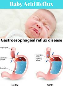 Symptoms of acid reflux in babies infants