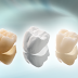 Tìm hiểu về độ bền của răng sứ cercon