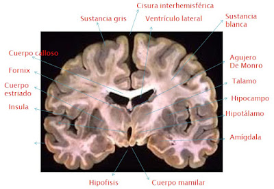 Resultado de imagen de corte transversal del cerebro