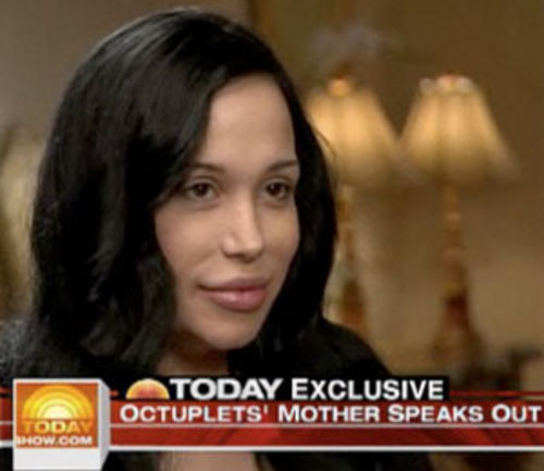 nadya suleman before and after