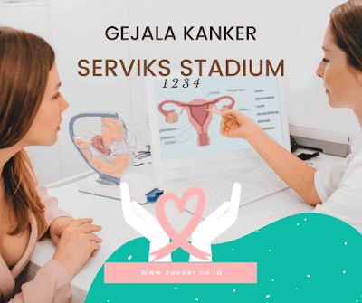 gejala kanker serviks stadium 1 2 3 4