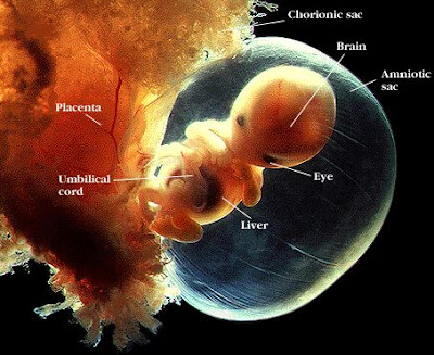 fetus at 12 weeks. Human Embryo Close-up of a