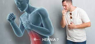 Coughing while standing & Hernia