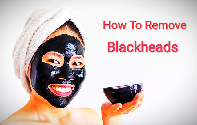 How To Remove Blackheads