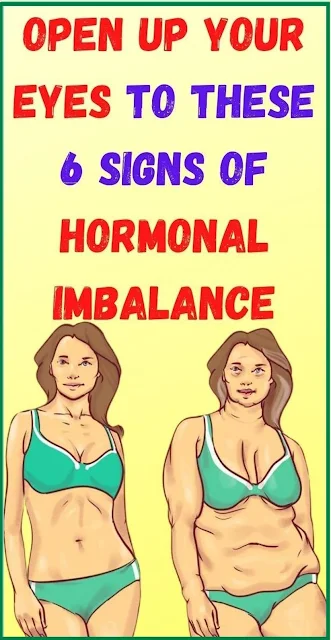 Open Up Your Eyes To These 6 Signs Of Hormonal Imbalance