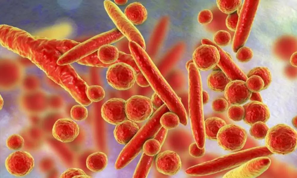 Kasus Mycoplasma Pneumoniae Ditemukan Di Indonesia