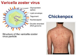 picture of the varicella zoster virus which is very contagious and spreads chicken pox 