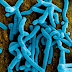 Marburg Virus Sweeps Through Rwanda: WHO Issues Global Alert Amid Surge In Cases