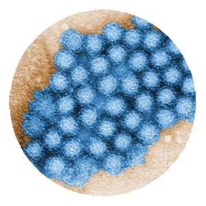 NOROVIRUS