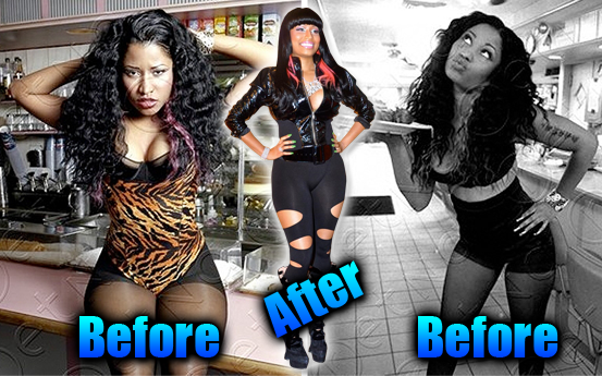 nicki minaj before surgery photos. Nicki Minaj Before The Plastic