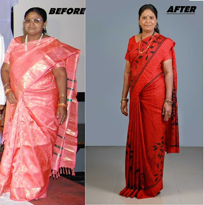 weight loss in hyderabad