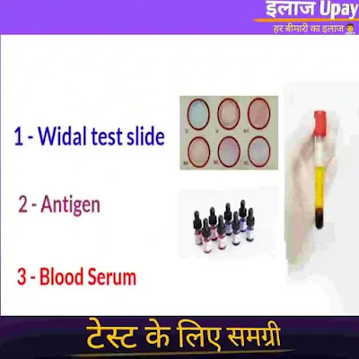 widal test in hindi , widal test positive means in hindi , typhi o positive means in hindi , typhi h positive means in hindi , widal test kit , typhoid test report , typhoid test ,