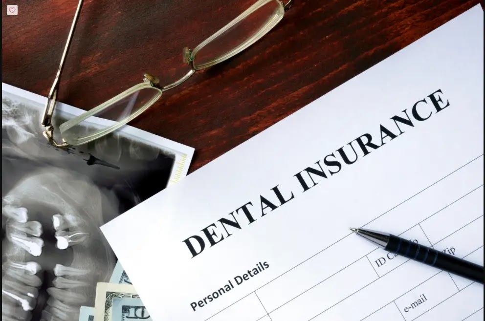 what insurance covers dental implants