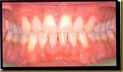 Orthodonture after