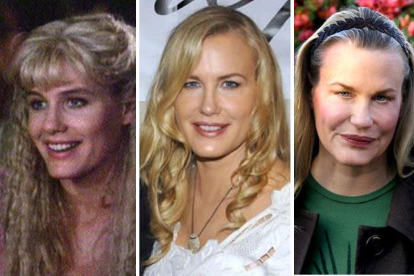 Photo Daryl Hannah Operasi Plastik