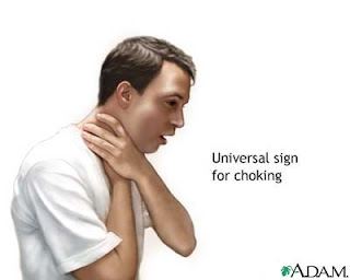 choking signs and cure