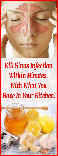 Natural Home Remedy to Cure Sinusitis