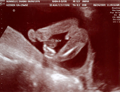 ultrasound images of girls and boys. Looks like we'll have a boy as the baby of the family! The Ultrasound Lady 