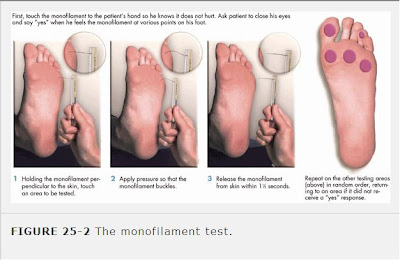 Test vibratory sense over interphalangeal joints of the feet using a ...