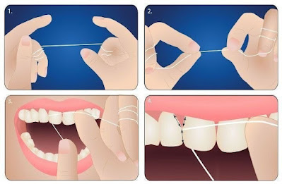 치아관리의 기본-치실 사용하는 방법 : 기본적으로 치실 사용하는 방법