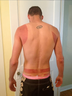 Photo of my bare back exposing my obscure tan lines I earned completing Ironman Texas May 2013