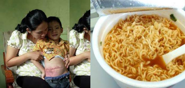 Akibat terlalu makan mee maggi setiap hari, lihat hasilnya 